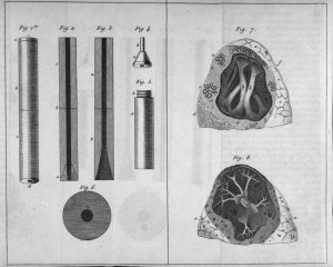 Laennec's Stethoscope